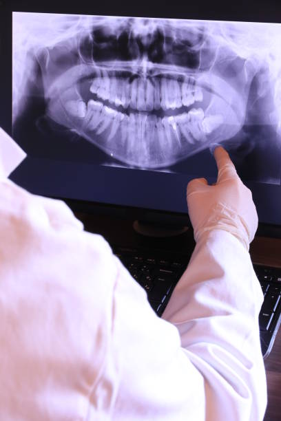 Best Emergency Dental Care for Abscessed Tooth in Fort Stockton, TX