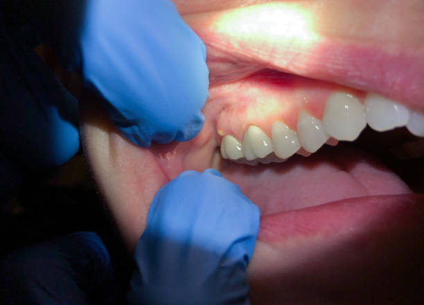 Best Broken or Cracked Tooth Emergency Dentist in Fort Stockton, TX